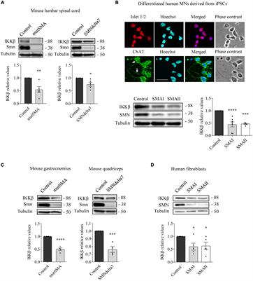 Survival motor neuron protein and neurite degeneration are regulated by Gemin3 in spinal muscular atrophy motoneurons